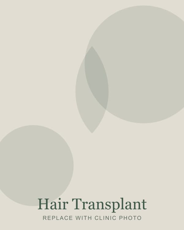 Hair transplant consultation